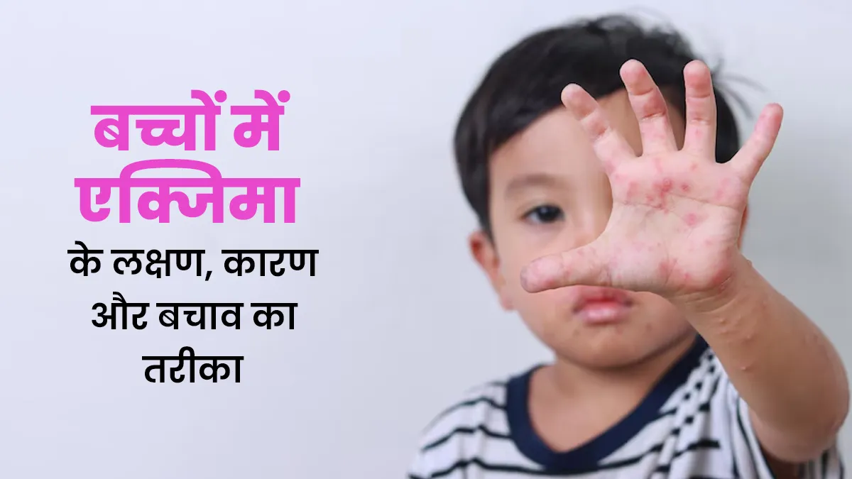 बच्चों में एक्जिमा होने के क्या कारण हो सकते हैं? जानें इसके लक्षण और बचाव का तरीका