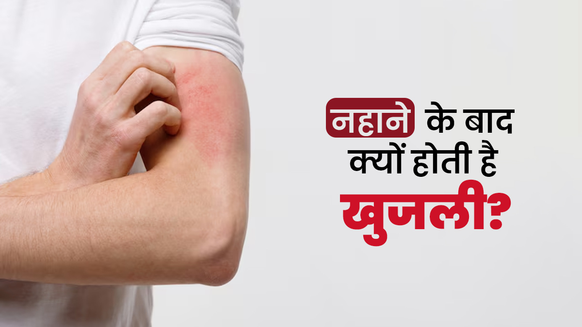 नहाने के बाद क्यों होती है खुजली? डॉक्टर से जानें इसके कारण और बचाव के लिए उपाय