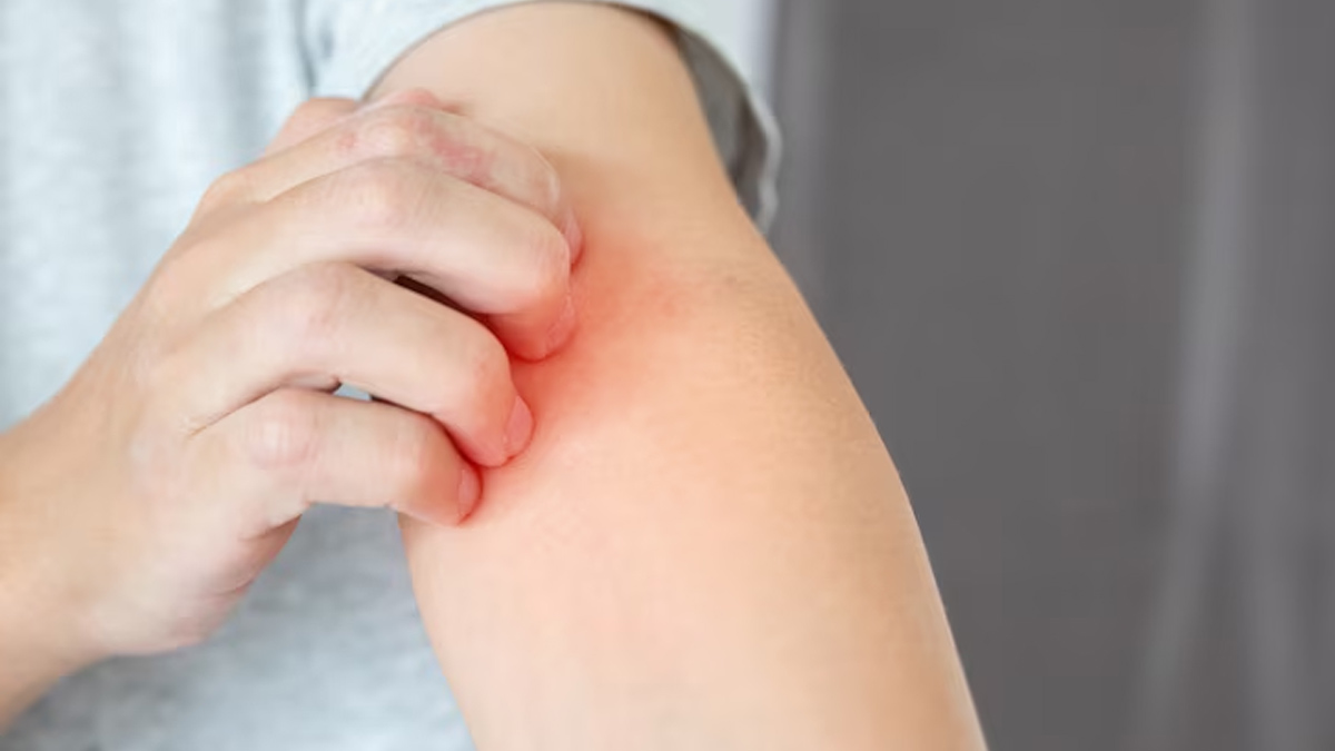 itching after bathing