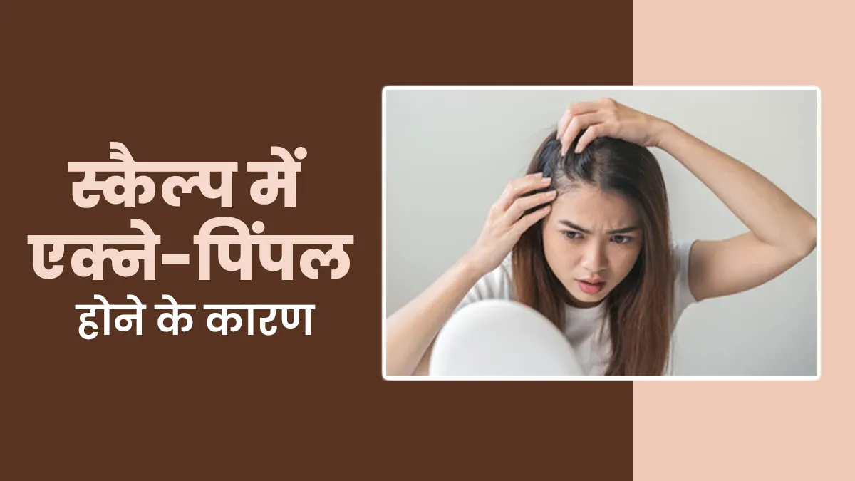 स्कैल्प में एक्ने-पिंपल होने के क्या कारण हैं? एक्सपर्ट से जानें