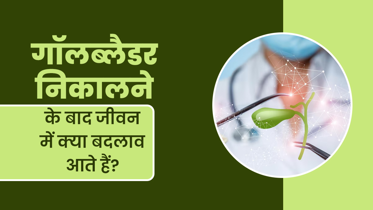 गॉलब्लैडर निकालने के बाद जीवन में क्या बदलाव आते हैं? डॉक्टर से जानें