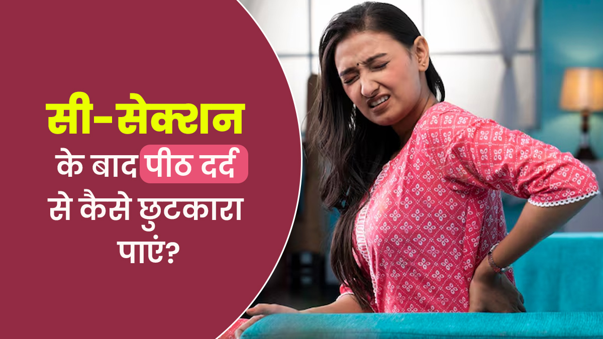सी-सेक्शन के बाद पीठ दर्द से कैसे छुटकारा पाएं? डॉक्टर से जानें असरदार तरीके