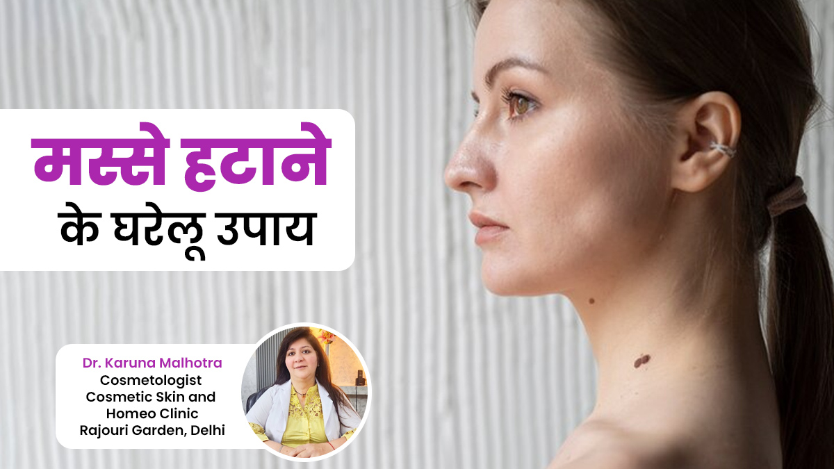 क्या आप भी अपने मस्सों से परेशान हैं? हटाने के लिए अपनाएं एक्सपर्ट के बताए ये 5 घरेलू उपाय
