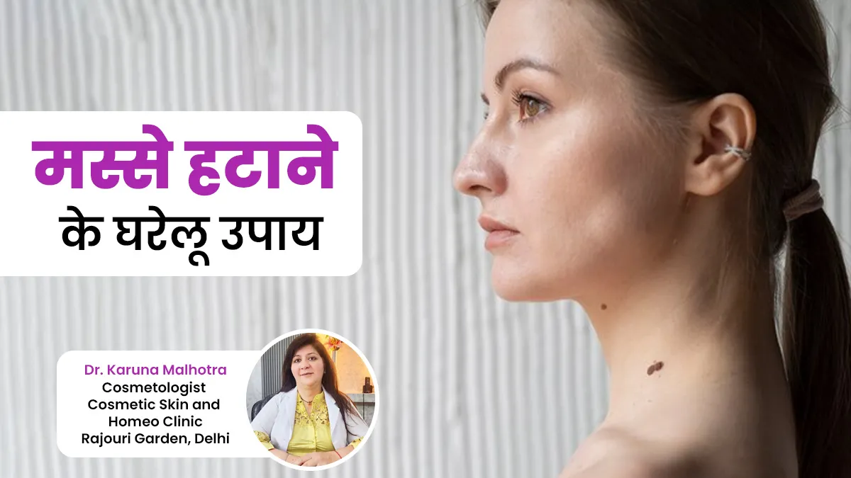 क्या आप भी अपने मस्सों से परेशान हैं? हटाने के लिए अपनाएं एक्सपर्ट के बताए ये 5 घरेलू उपाय

