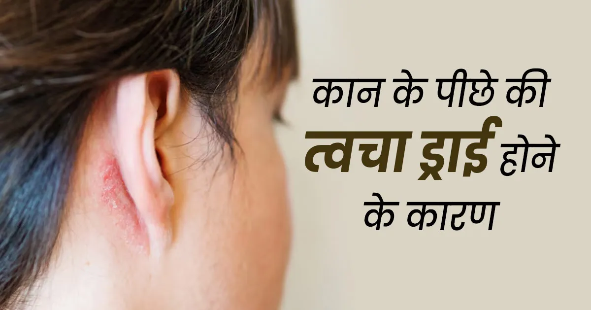 कान के पीछे की त्वचा ड्राई क्यों हो जाती है? जानें कारण और राहत पाने के उपाय