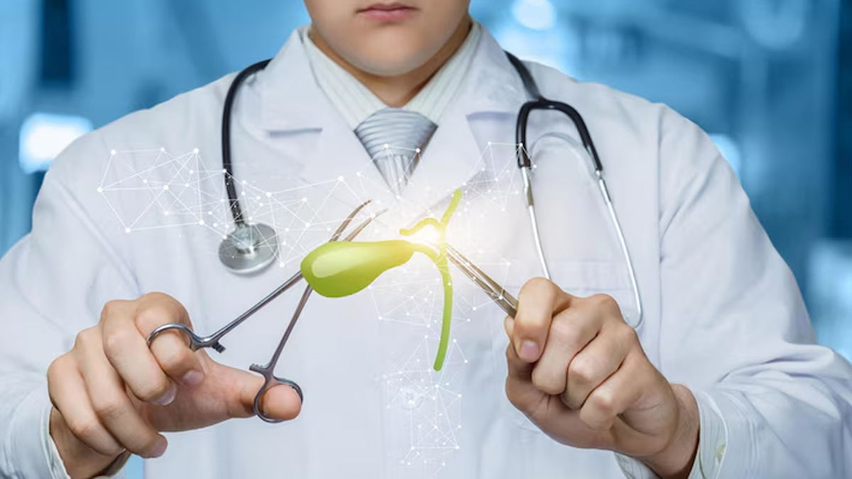 How is life different after gallbladder removal