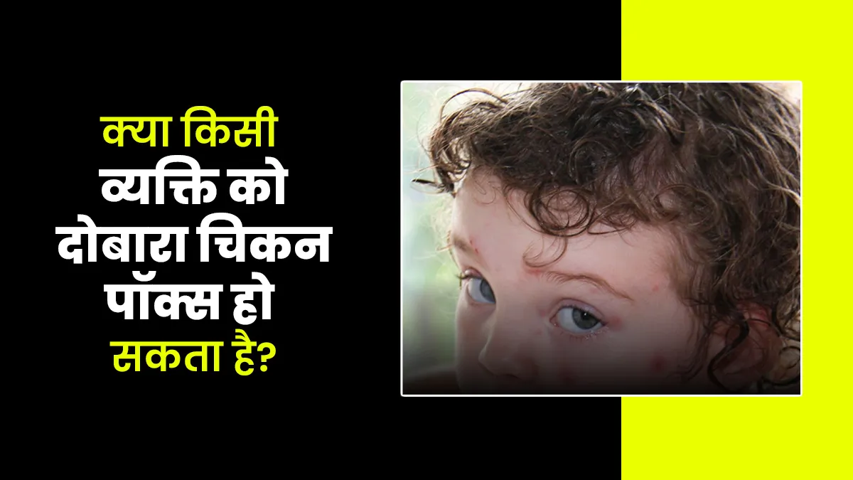 क्या किसी व्यक्ति को दोबारा से चिकन पॉक्स हो सकता है? जानें डॉक्टर से