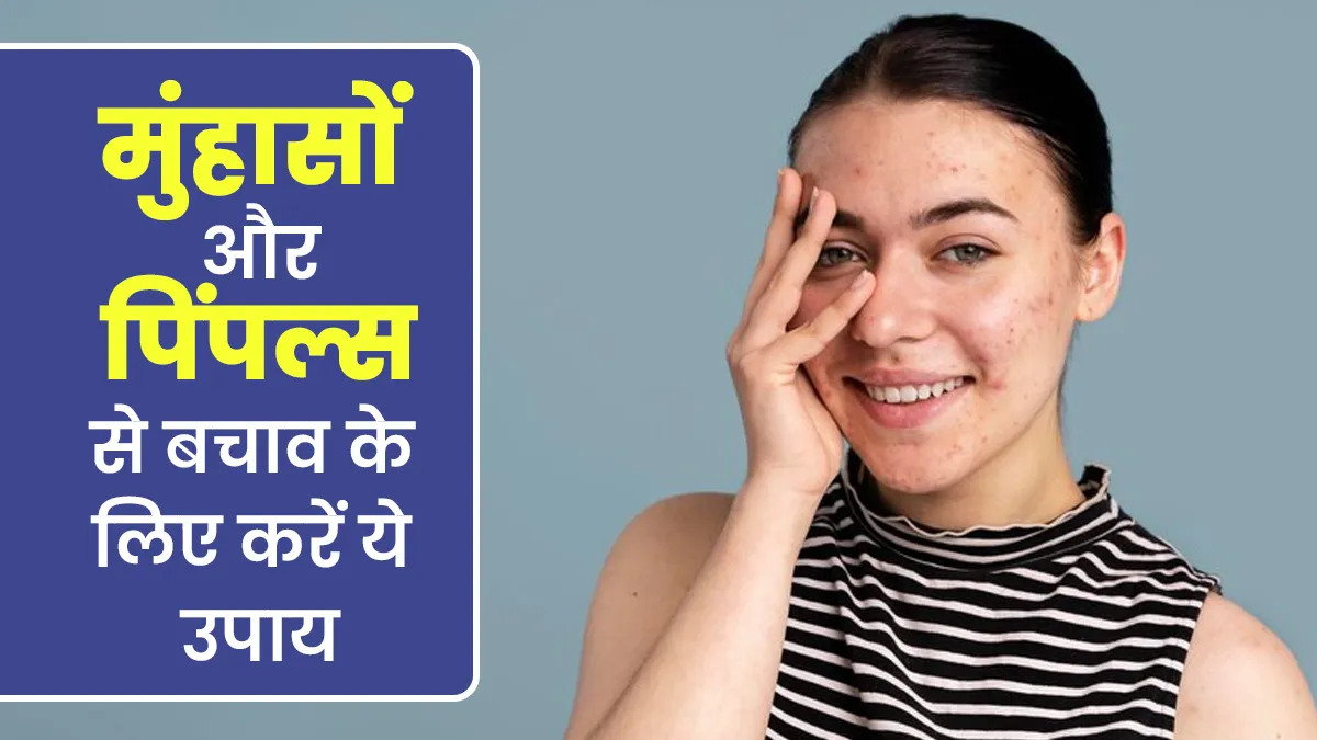 मुंहासों और पिंपल्स से बचाव के लिए करें ये उपाय, एक्सपर्ट से जानें