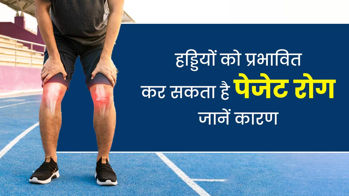 हड्डियों को प्रभावित कर सकता है पेजेट रोग, जानें इसके कारण और लक्षण