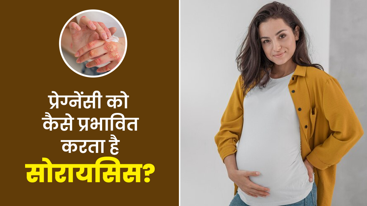 प्रेग्नेंसी को कैसे प्रभावित करता है सोरायसिस? डॉक्टर से समझें