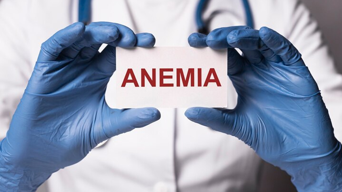 can-anemia-cause-severe-hair-loss-in