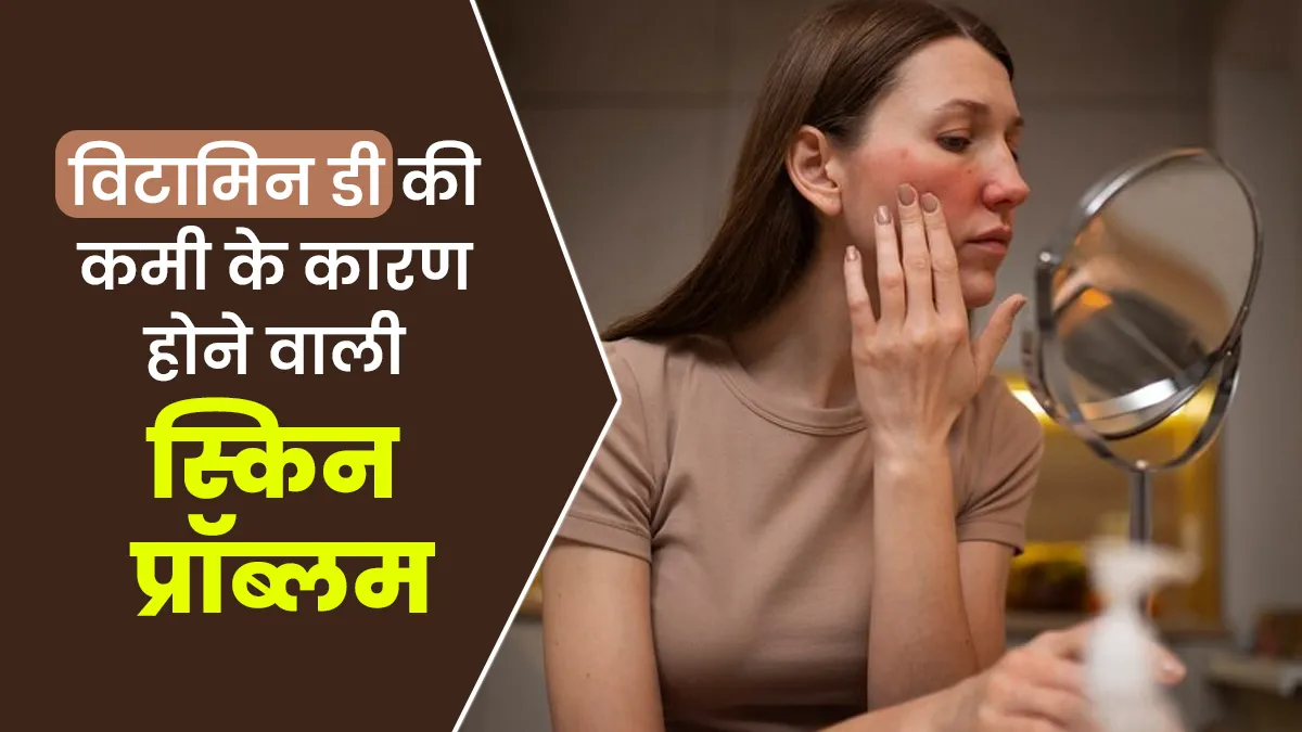 विटामिन-डी की कमी के कारण हो सकती हैं ये 5 स्किन से जुड़ी समस्याएं, बरतें सावधानी