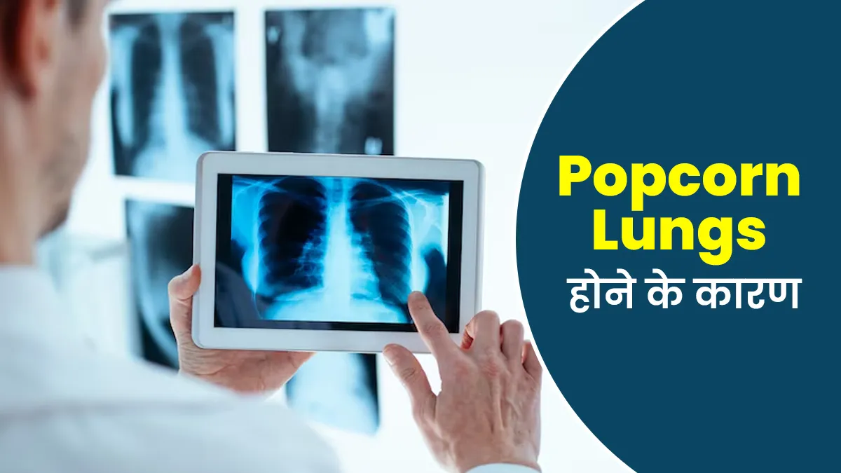 क्या सिर्फ वेपिंग से होती है Popcorn Lungs की समस्या? एक्सपर्ट से जानें इसके कारण और लक्षण