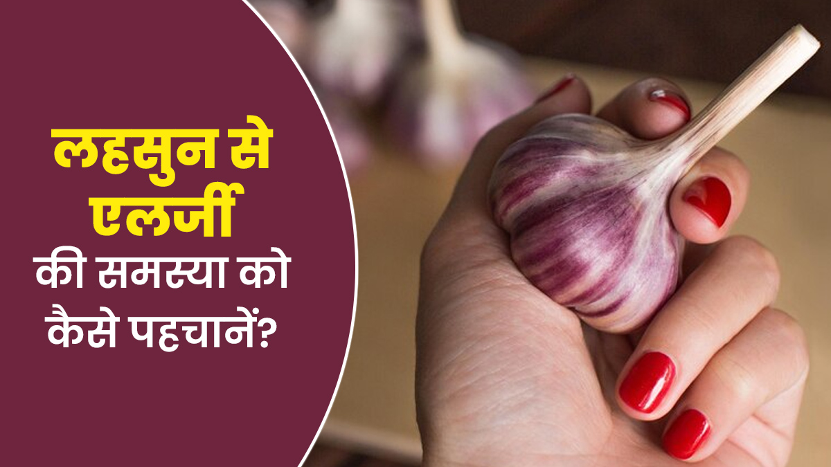 लहसुन से एलर्जी की समस्या को कैसे पहचानें? डॉक्टर से जानें 4 संकेत