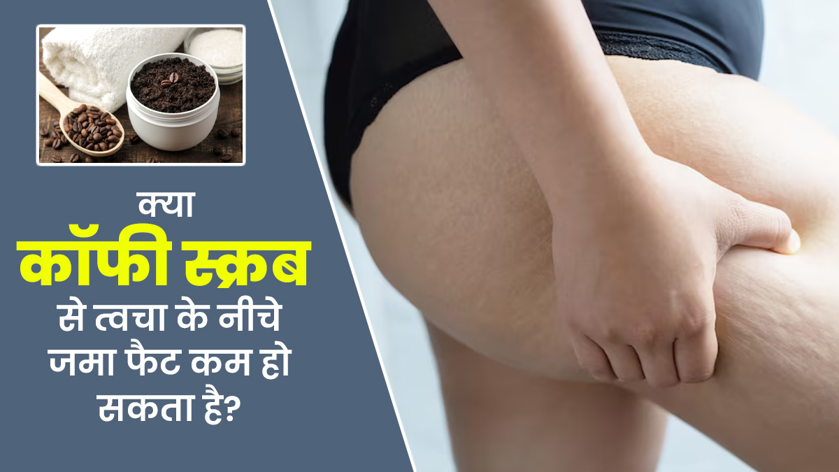 क्या कॉफी स्क्रब सेल्युलाईट (त्वचा के नीचे जमा फैट) को कम करने में मदद कर सकता है? डॉक्टर से जानें