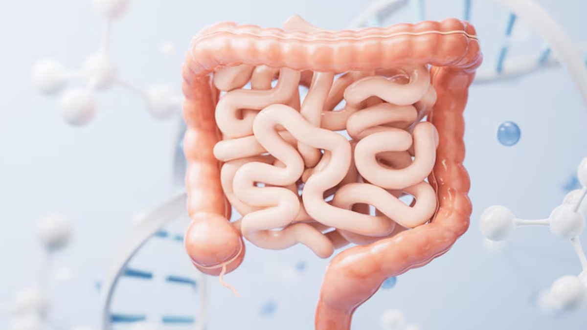 Foods to avoid in intestinal TB