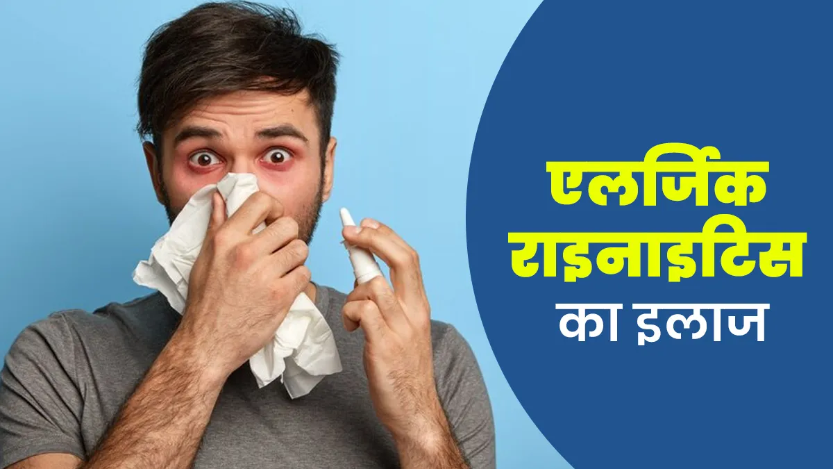 क्या एलर्जिक राइनाइटिस में भाप लेना फायदेमंद है? डॉक्टर ने बताया इस समस्या का सटीक इलाज