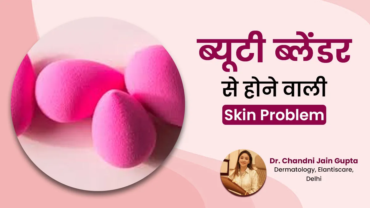 गंदा ब्यूटी ब्लेंडर के कारण हो सकती हैं ये 5 स्किन प्रॉब्लम, यूं रखें साफ-सफाई का ध्यान