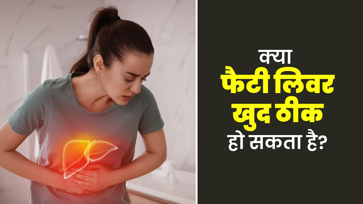 क्या फैटी लिवर खुद ठीक हो सकता है? जानें डॉक्टर से