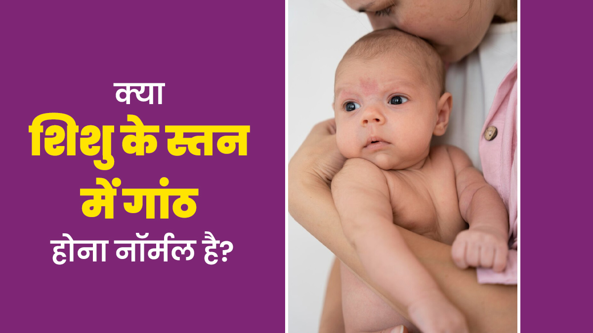 क्या शिशु के स्तन में गांठ होना सामान्य है? डॉक्टर से जानें