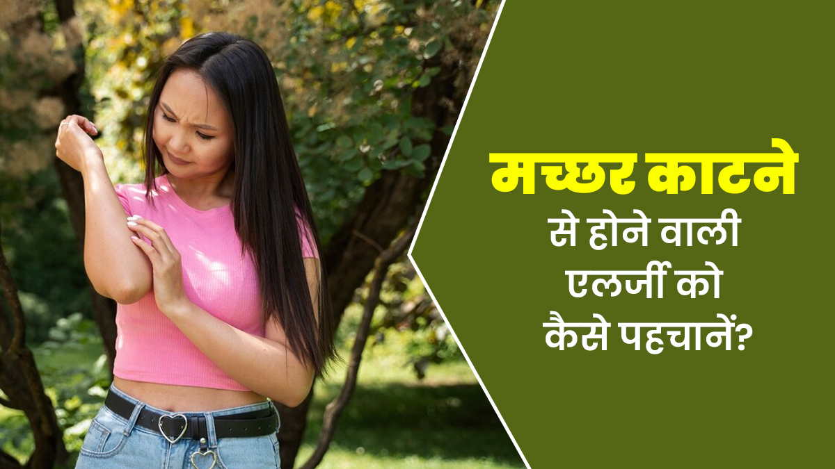 World Malaria Day 2025: कैसे पहचाने कि आपको मच्छर के काटने से एलर्जी है? जानें डॉक्टर से
