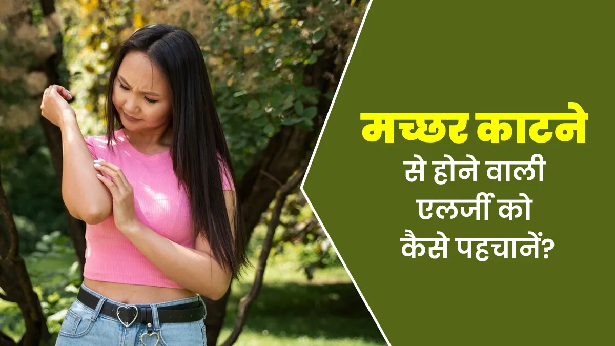 World Malaria Day 2025: कैसे पहचाने कि आपको मच्छर के काटने से एलर्जी है? जानें डॉक्टर से
