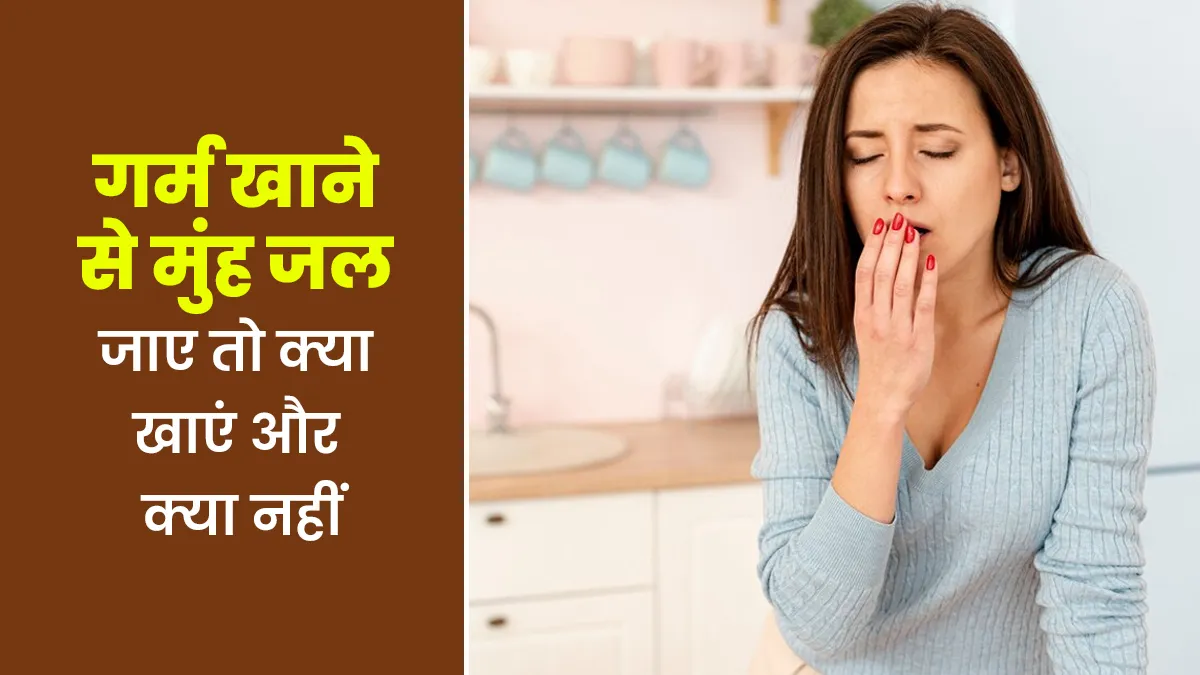 गर्म खाने से मुंह जल जाए तो क्या खाना चाहिए और किन चीजों से करें परहेज, डॉक्टर से जानें