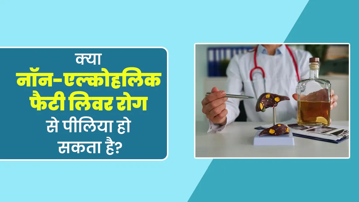 क्या नॉन-एल्कोहलिक फैटी लिवर रोग से पीलिया हो सकता है? डॉक्टर से जानें
