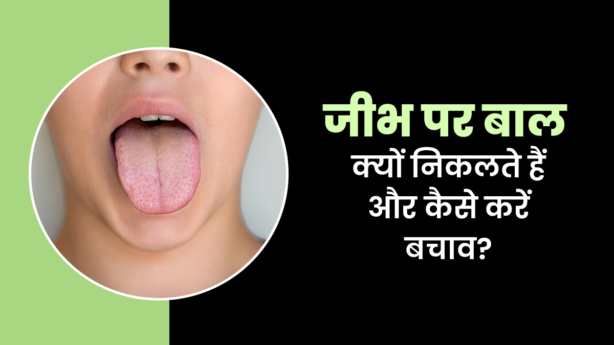 जानें क्यों निकलते हैं जीभ पर बाल? जानें इसके कारण और कैसे करें इलाज?
