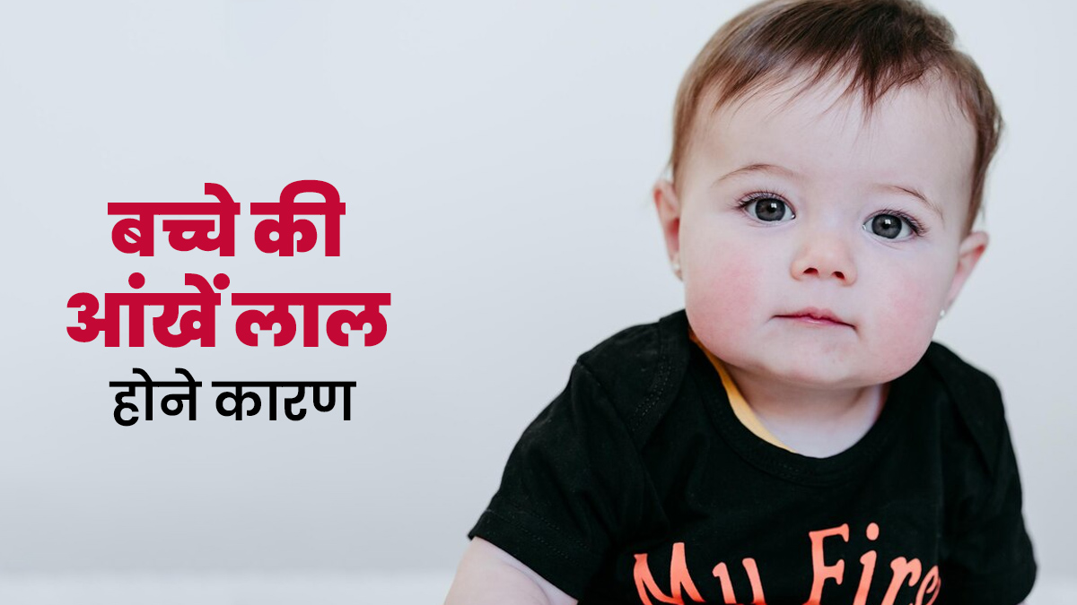 बच्चे की आंखें लाल होने के क्या हैं कारण? जानें ऐसे में पैरेंट्स क्या करें