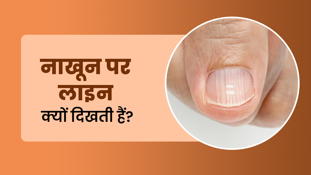 नाखून पर लाइन क्यों दिखती हैं? एक्सपर्ट से जानें