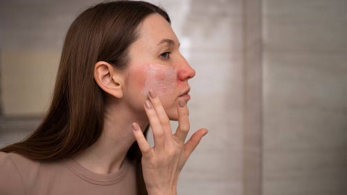 dehydrated oily skin