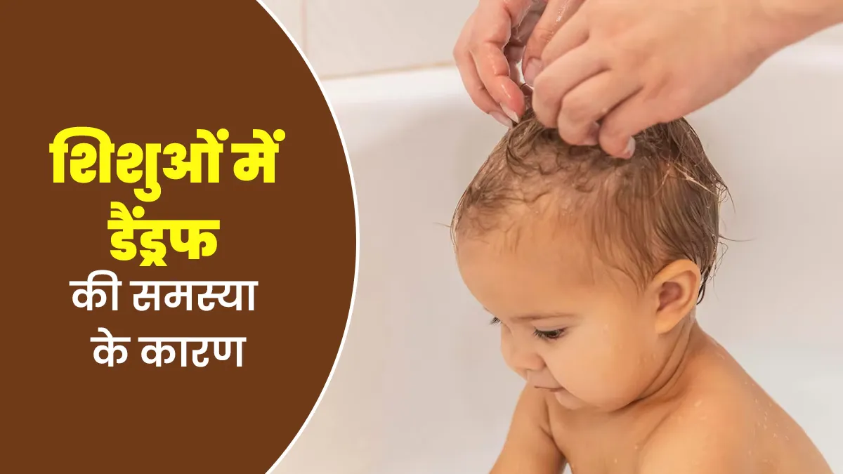 क्या शिशुओं में डैंड्रफ की समस्या हो सकती है? जानें इसके कारण और बचाव के टिप्स