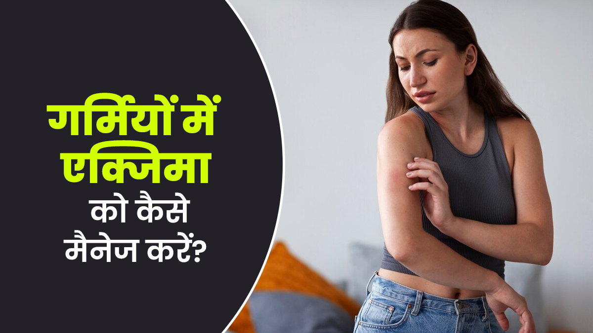 गर्मियों में एक्जिमा को मैनेज करने के लिए अपनाएं ये 5 आसान तरीके, जानें डॉक्टर से