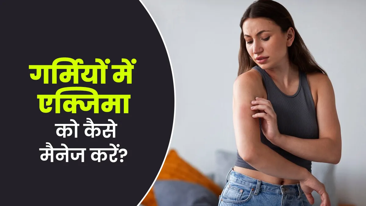 गर्मियों में एक्जिमा को मैनेज करने के लिए अपनाएं ये 5 आसान तरीके, जानें डॉक्टर से
