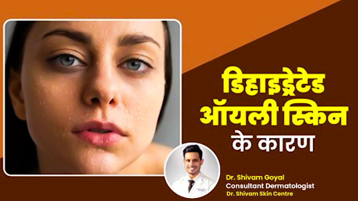 डिहाइड्रेटेड ऑयली स्किन के क्या कारण हैं? डॉक्टर से जानें