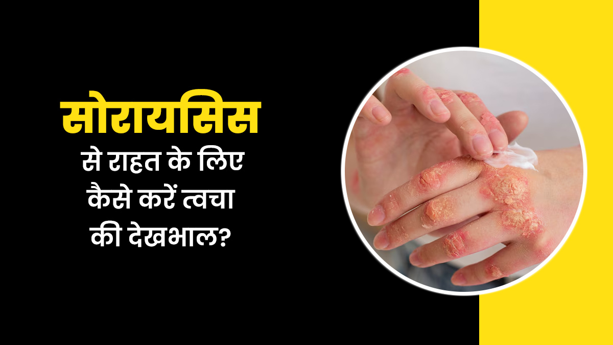 सोरायसिस के लक्षणों को कम करने के लिए कैसे करें त्वचा की देखभाल, एक्सपर्ट से जानें