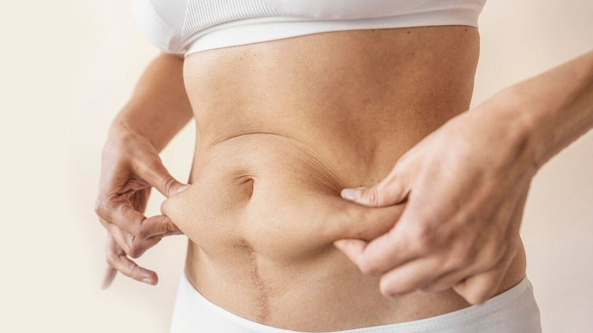 Home Remedies to Burn Belly Fat Naturally Home-Remedies-to-Burn-Belly-Fat-Naturally-inside2