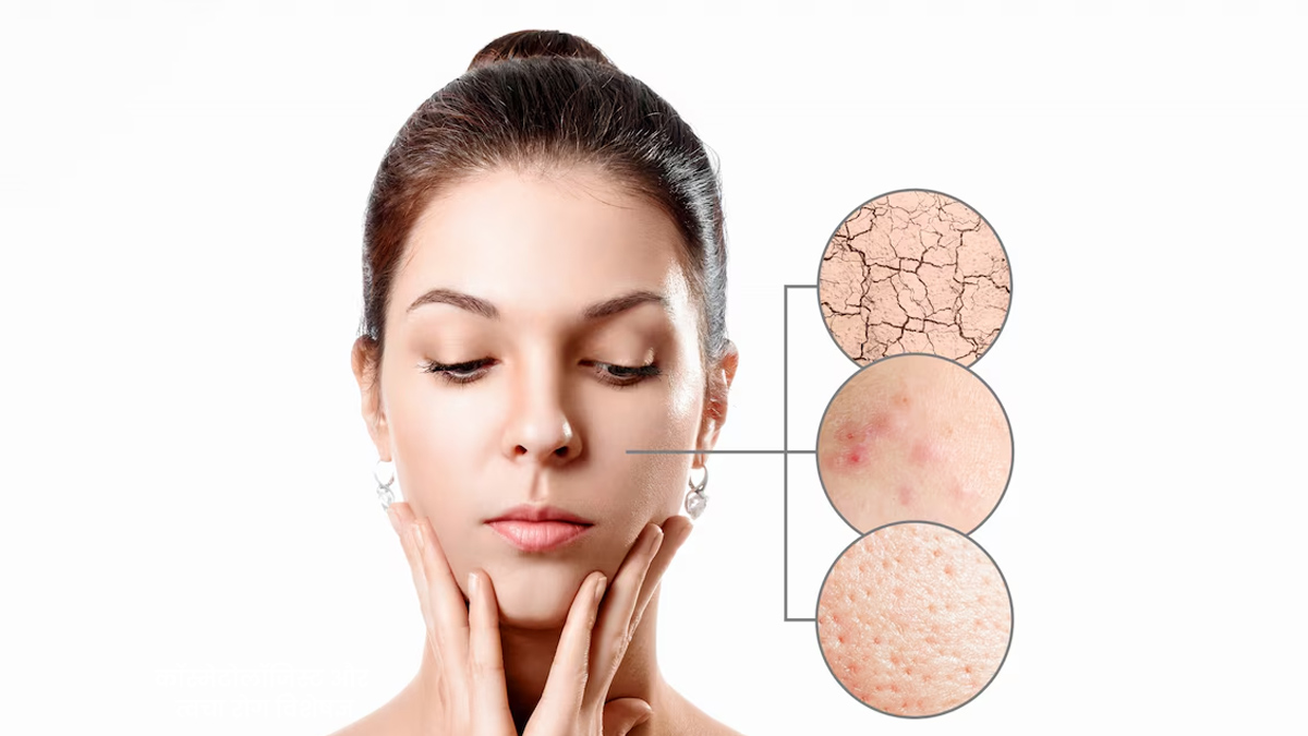 what causes skin dullness in summer 01 (4)