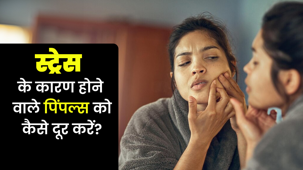 स्ट्रेस की वजह चेहरे पर निकल आएं हैं पिंपल्स, तो दूर करने के लिए अपनाएं ये आसान उपाय