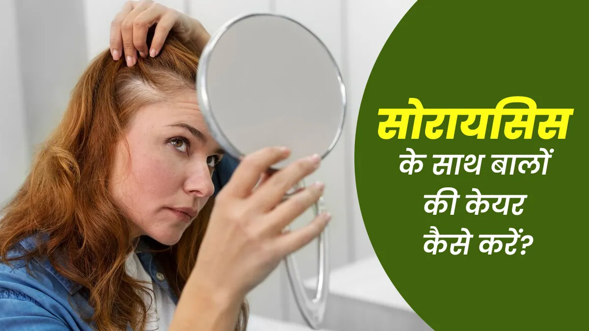 सोरायसिस होने पर अच्छी तरह से बालों की देखभाल कैसे कर सकते हैं? जानें डॉक्टर की राय