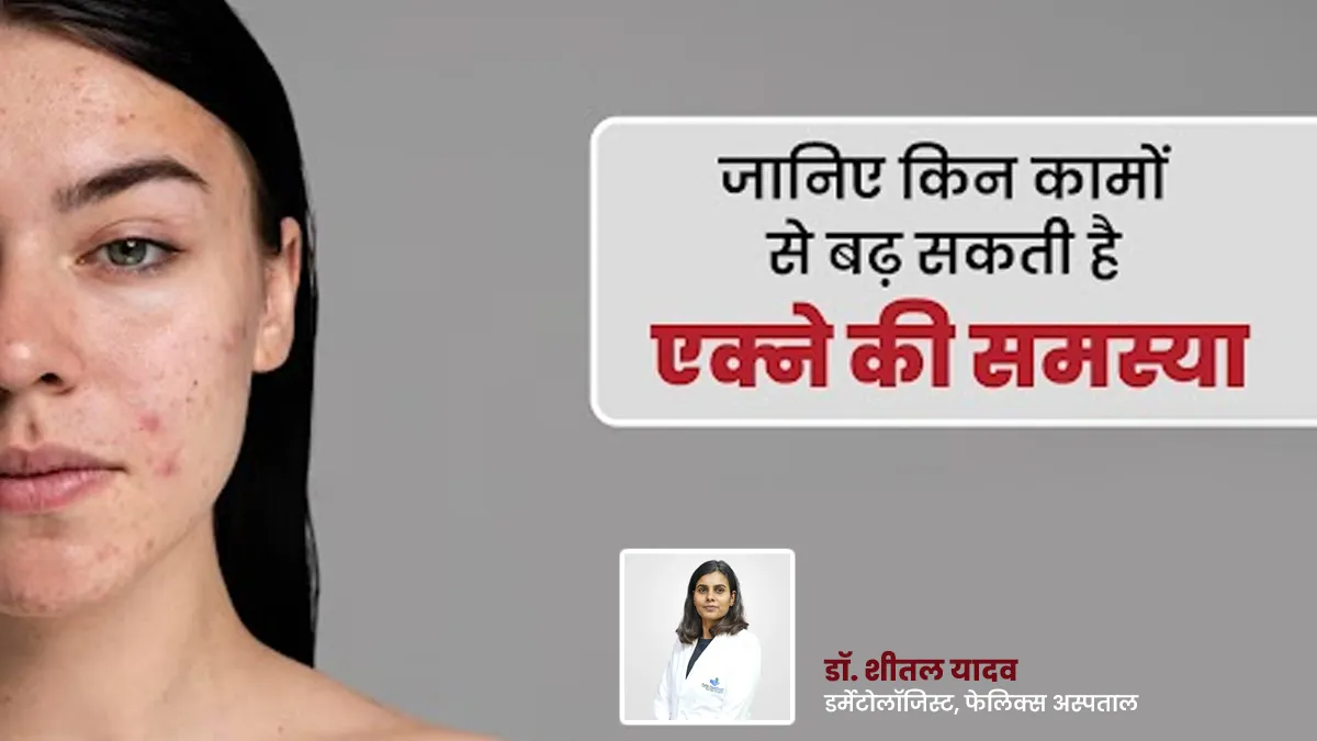 इन कामों को करने से बढ़ सकती है एक्ने की समस्या, एक्सपर्ट से जानें बचाव के टिप्स