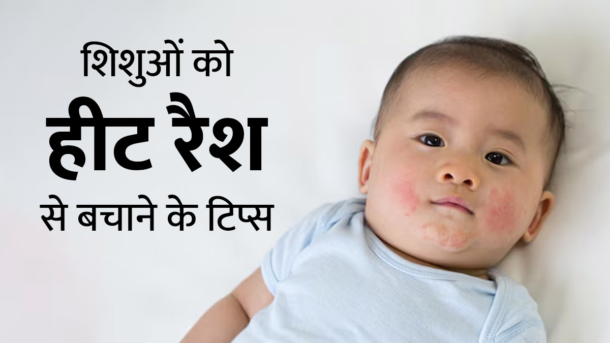 गर्मियों में शिशुओं को हीट रैश से बचाने के लिए अपनाएं ये 6 उपाय