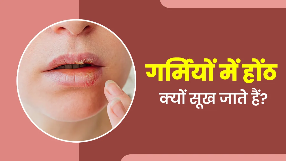 गर्मियों में होंठ क्यों सूखते हैं? जानें इसके कारण और राहत पाने के उपाय