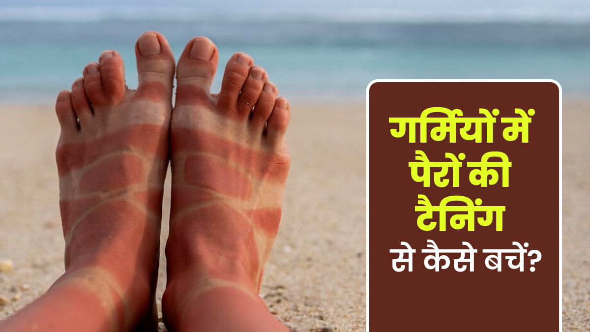 गर्मियां आते ही पैरों में होने लगती है टैनिंग? जानें इससे बचने के तरीके