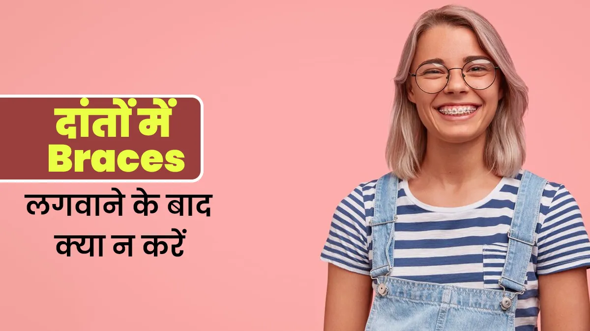 दांतों में ब्रेसेस (Braces) लगवाने के बाद न करें ये 5 काम, हो सकता है भारी नुकसान