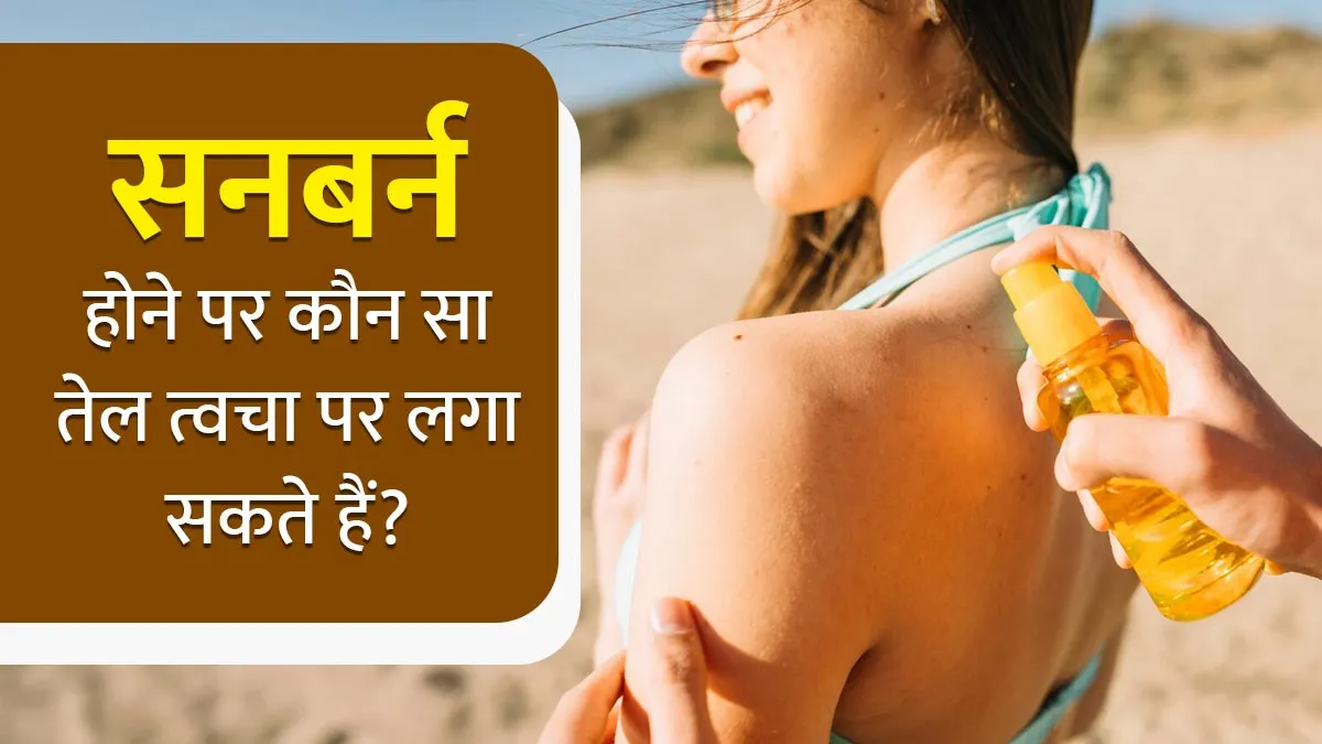 सनबर्न होने पर कौन सा तेल त्वचा पर लगा सकते हैं? एक्सपर्ट से जानें