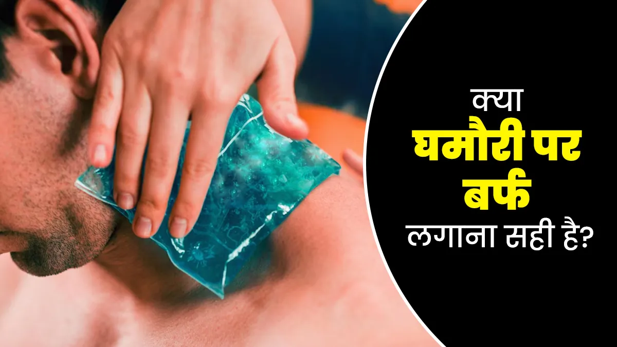 क्या घमौरी होने पर बर्फ लगाना सुरक्षित होता है? जानें डॉक्टर से