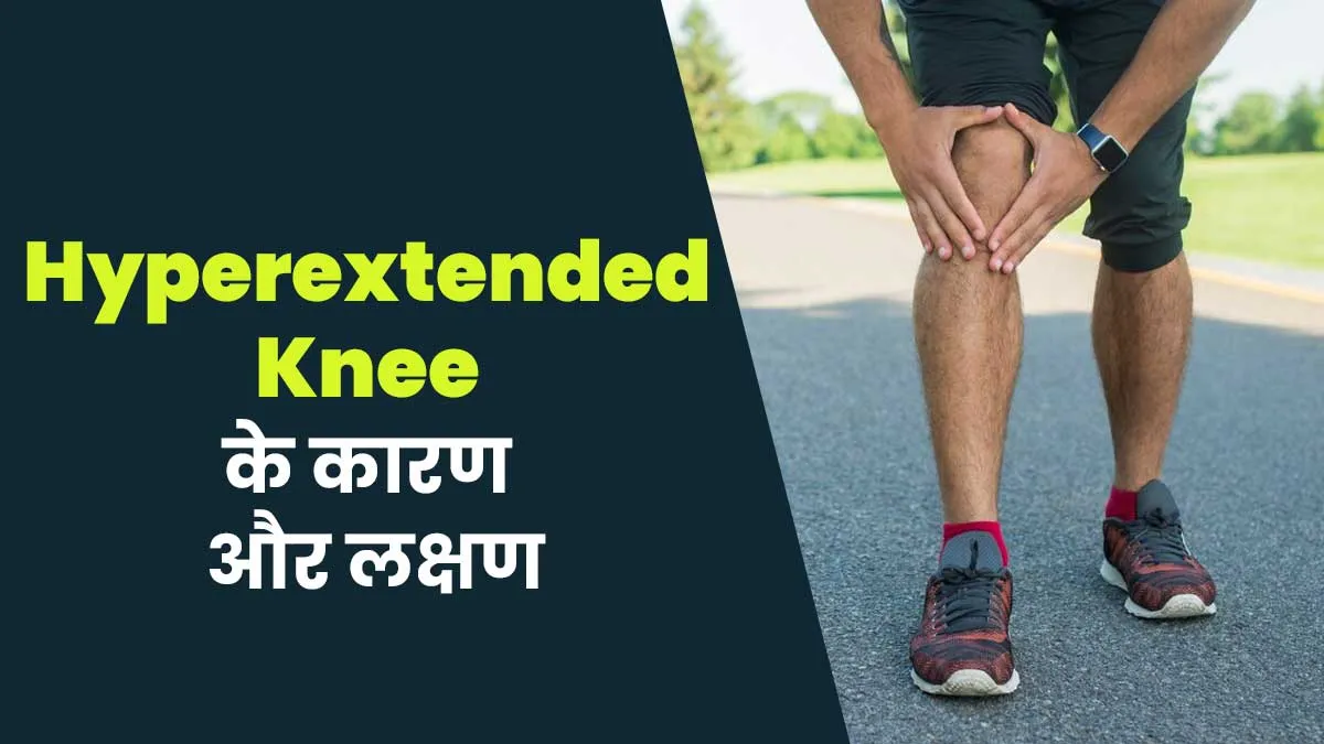 घुटनों को प्रभावित करता है hyperextended knee, डॉक्टर से जानें इसके लक्षण और कारण