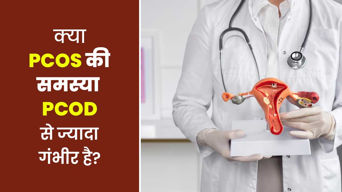 क्या PCOS की समस्या PCOD से ज्यादा गंभीर होती है? डॉक्टर से जानें जवाब